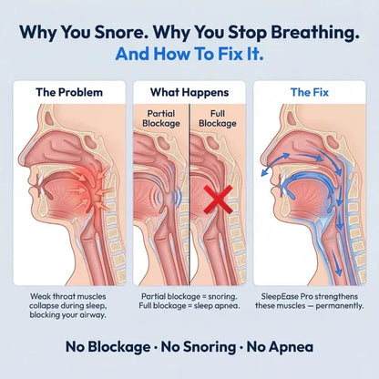 SleepEase Pro — Eliminates Snoring & Sleep Apnoea